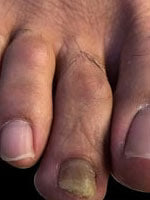A must-try for nail issues!