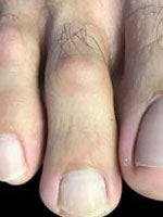 A must-try for nail issues!