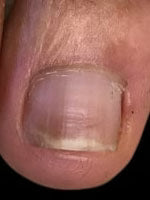 My nails have never looked better!