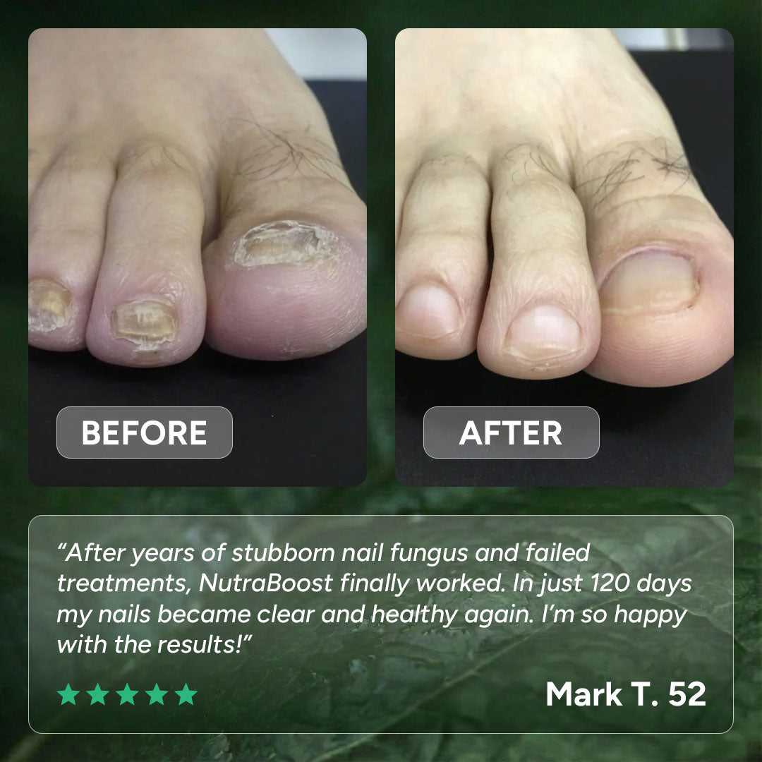 Complete Nail Renewal